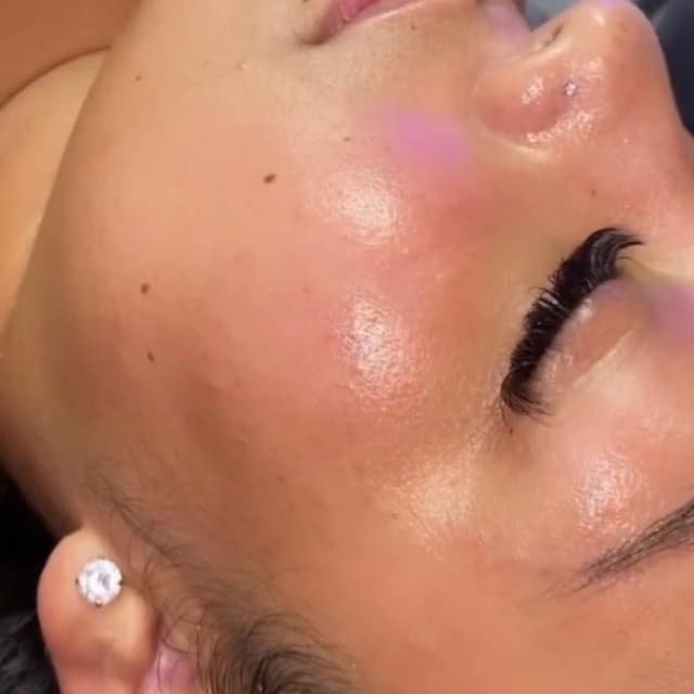 Glow Monthly Facial Membership ✨ at Regal Glow Aesthetics in Fairfield, CA