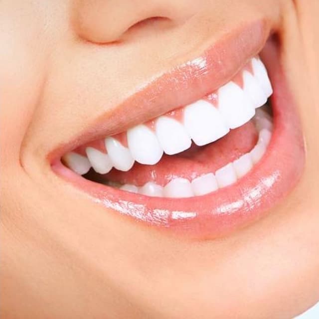 Bright Smile Club ✨ at Regal Glow Aesthetics in Fairfield, CA